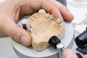 Manufacturing of a dental artificial limb.