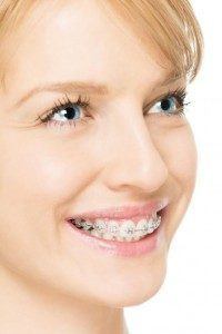 Blonde woman smiling with braces on.