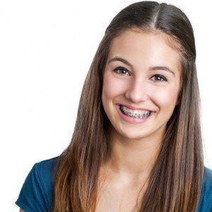 Young teenage girl smiling with braces.