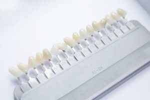 Denture and implant production: false teeth color samples